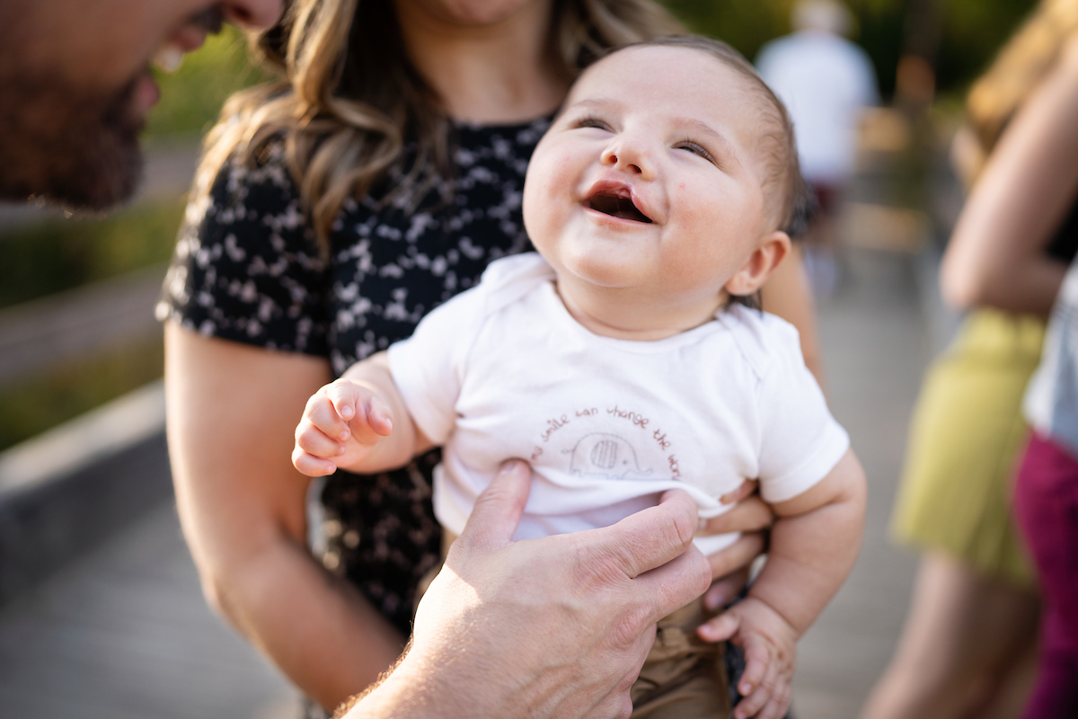 Cleft Lip and Palate: A Comprehensive Guide